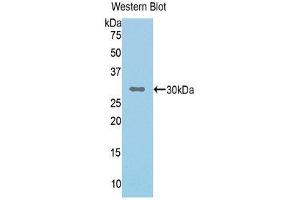 Western Blotting (WB) image for anti-Complement Factor I (CFI) (AA 340-583) antibody (ABIN3205710) (Complement Factor I antibody  (AA 340-583))