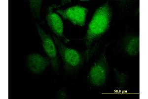 Immunofluorescence of monoclonal antibody to HIPK1 on HeLa cell. (HIPK1 antibody  (AA 330-430))