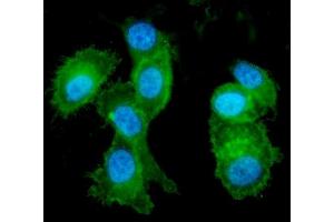 IF analysis of Eph receptor A2 using anti-Eph receptor A2 antibody (ABIN5693218).