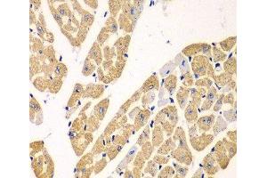 Immunohistochemistry of paraffin-embedded Mouse heart using KYNU Polyclonal Antibody at dilution of 1:100 (40x lens). (KYNU antibody)