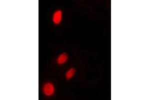 Immunofluorescent analysis of TP53INP2 staining in HeLa cells. (TP53INP2 antibody  (N-Term))