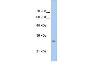 WB Suggested Anti-NSBP1 Antibody Titration:  0. (HMGN5 antibody  (Middle Region))