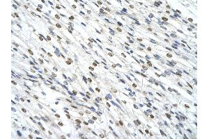 Immunohistochemistry (IHC) image for anti-SWI/SNF Related, Matrix Associated, Actin Dependent Regulator of Chromatin, Subfamily D, Member 2 (SMARCD2) (C-Term) antibody (ABIN2780464)
