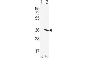 Western Blotting (WB) image for anti-N-Acetyltransferase 2 (Arylamine N-Acetyltransferase) (NAT2) antibody (ABIN3002917) (NAT2 antibody)