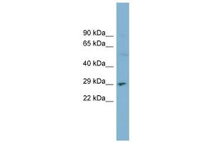 DNASE1 antibody used at 1 ug/ml to detect target protein. (DNASE1 antibody  (N-Term))