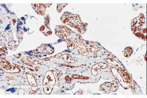 ABIN185194 (2µg/ml) staining of paraffin embedded Human Placenta. (PIK3C2A antibody  (C-Term))