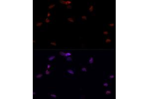 Immunofluorescence (IF) image for anti-Poly (ADP-Ribose) Polymerase 1 (PARP1) (AA 81-390) antibody (ABIN6145232)