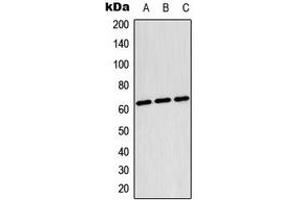 Western blot analysis of TESK2 expression in Raji (A), HepG2 (B), NIH3T3 (C) whole cell lysates.
