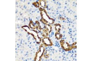 Immunohistochemistry of paraffin-embedded mouse kidney using Calbindin antibody (ABIN7266004) at dilution of 1:100 (40x lens). (CALB1 antibody  (AA 1-261))