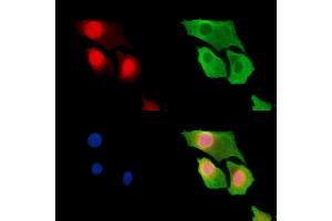 ABIN7095426 and ABIN7099483 staining Hela cells by IF/ICC.