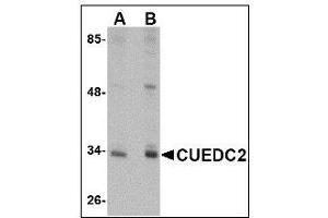 Western blot analysis of CUEDC2 in HeLa cell lysate with CUEDC2 antibody at (A) 1 and (B) 2 µg/ml