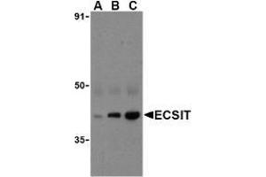 Western blot analysis of ECSIT in human heart cell lysates with AP30308PU-N ECSIT antibody at (A) 0. (ECSIT antibody  (C-Term))