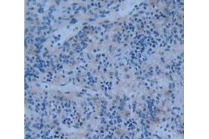 Used in DAB staining on fromalin fixed paraffin- embedded Kidney tissue (PTPRH antibody  (AA 551-802))