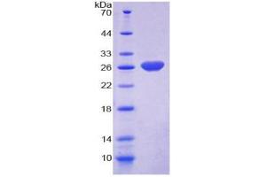 Image no. 1 for RAS P21 Protein Activator (GTPase Activating Protein) 1 (RASA1) (AA 403-596) protein (His tag) (ABIN6237936) (RASA1 Protein (AA 403-596) (His tag))