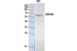 Western Blotting (WB) image for anti-Zinc Finger Protein 384 (ZNF384) (Internal Region) antibody (ABIN3178547) (ZNF384 antibody  (Internal Region))
