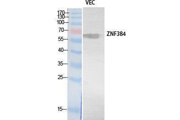 ZNF384 antibody  (Internal Region)