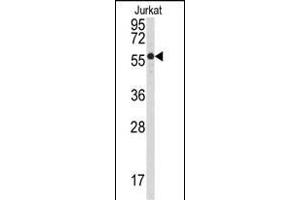 Western blot analysis of anti-P3CB Antibody (N-term) (ABIN392893 and ABIN2842292) in Jurkat cell line lysates (35 μg/lane). (PPP3CB antibody  (N-Term))