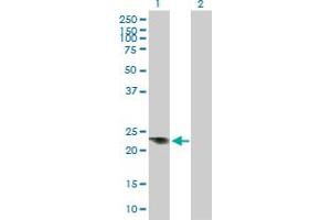 Western Blot analysis of SRY expression in transfected 293T cell line by SRY MaxPab polyclonal antibody.
