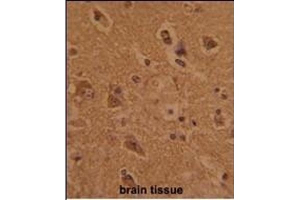 CTDP1 antibody  (N-Term)