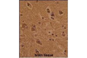 Formalin-fixed and paraffin-embedded human brain tissue with CTDP1 Antibody (N-term), which was peroxidase-conjugated to the secondary antibody, followed by DAB staining. (CTDP1 antibody  (N-Term))