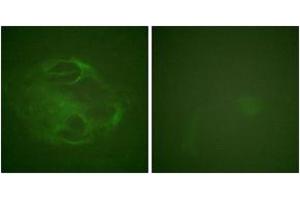 Immunofluorescence (IF) image for anti-Hepatocyte Growth Factor-Regulated tyrosine Kinase Substrate (HGS) (AA 301-350) antibody (ABIN2888879) (HGS antibody  (AA 301-350))