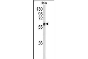 Western blot analysis of GALNT2 Antibody (N-term) (ABIN653281 and ABIN2842795) in Hela cell line lysates (35 μg/lane). (GALNT2 antibody  (N-Term))