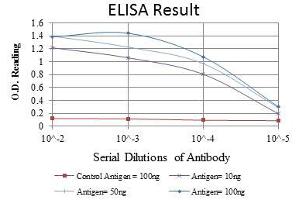 Red: Control Antigen (100 ng), Purple: Antigen (10 ng), Green: Antigen (50 ng), Blue: Antigen (100 ng), (CDK9 antibody)