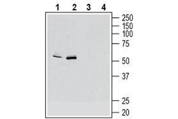 CX3CR1 anticorps  (Extracellular, N-Term)