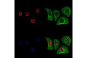 ABIN6256252 and ABIN6267454 staining Hela cells(4h of LPS treatment) by IF/ICC. (MKP1/2 (pSer296), (pSer318) antibody)