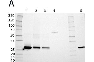 Expression analysis of rat GSTs of the mu and alpha classes. (GSTM1 antibody  (AA 1-218))