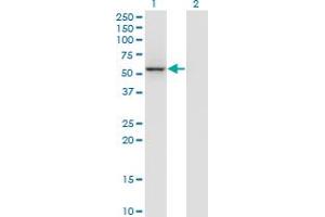 Western Blot analysis of GABPB2 expression in transfected 293T cell line by MGC29891 monoclonal antibody (M01), clone 3A3-1F4. (GABPB2 antibody  (AA 1-448))