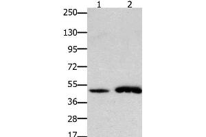 Western Blot analysis of Mouse brain and heart tissue using FOXL2 Polyclonal Antibody at dilution of 1:750 (FOXL2 antibody)