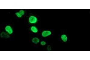 Anti-PPARA mouse monoclonal antibody (ABIN2455018) immunofluorescent staining of COS7 cells transiently transfected by pCMV6-ENTRY PPARA (RC216176). (PPARA antibody  (AA 145-420))