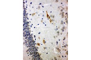 Anti-Somatostatin antibody, IHC(P) IHC(P): Rat Brain Tissue (Somatostatin antibody  (C-Term))