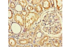 Immunohistochemistry of paraffin-embedded human kidney tissue using ABIN7173015 at dilution of 1:100 (TMPRSS7 antibody  (Ser7))