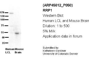 Image no. 2 for anti-Ribosomal RNA Processing 1 Homolog A (RRP1) (C-Term) antibody (ABIN2782369) (RRP1 antibody  (C-Term))
