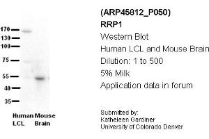 Image no. 2 for anti-Ribosomal RNA Processing 1 Homolog A (RRP1) (C-Term) antibody (ABIN2782369)