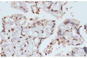 Immunohistochemistry of paraffin-embedded Human placenta using Phospho-CHEK1(S280) Polyclonal Antibody at dilution of 1:100 (40x lens). (CHEK1 antibody  (pSer280))