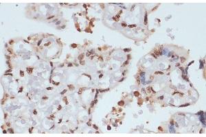 Immunohistochemistry of paraffin-embedded Human placenta using Phospho-CHEK1(S280) Polyclonal Antibody at dilution of 1:100 (40x lens).