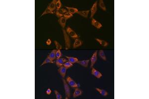 Immunofluorescence analysis of NIH-3T3 cells using Galectin 1/LG Rabbit mAb (ABIN7268197) at dilution of 1:100 (40x lens). (LGALS1/Galectin 1 antibody)