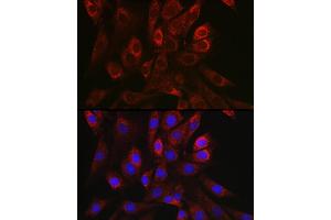 Immunofluorescence analysis of NIH/3T3 cells using TGF beta 1 antibody (ABIN7270909) at dilution of 1:150. (TGFB1 antibody  (AA 30-278))