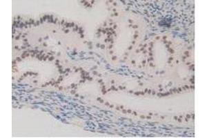 Figure. (HMGN1 antibody  (AA 1-96))