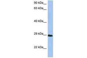 Image no. 1 for anti-Crystallin, beta A1 (CRYBA1) (N-Term) antibody (ABIN6743616) (CRYBA1 antibody  (N-Term))