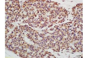 Formalin-fixed and paraffin embedded mouse embryo labeled with Rabbit Anti-EPS15R Polyclonal Antibody, Unconjugated  at 1:200 followed by conjugation to the secondary antibody and DAB staining (EPS15L1 antibody  (AA 275-380))