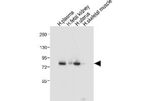 Western Blotting (WB) image for anti-Lactotransferrin (LTF) antibody (ABIN652643)