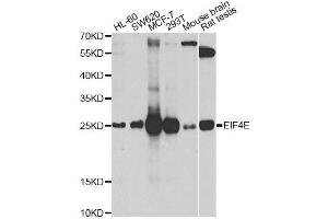 Western Blotting (WB) image for anti-Eukaryotic Translation Initiation Factor 4E (EIF4E) (AA 1-100) antibody (ABIN3023085)