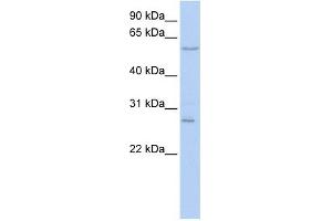 Neuropilin antibody used at 1 ug/ml to detect target protein. (Neuropilin 1 antibody  (N-Term))