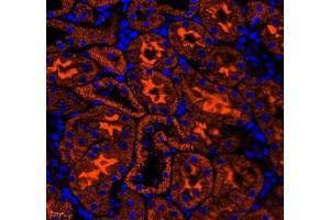 Immunofluorescence of paraffin embedded mouse kidney using NRP2 (ABIN7074826) at dilution of 1: 650 (400x lens) (NRP2 antibody)