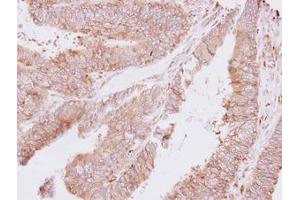 Image no. 1 for anti-threonyl-tRNA Synthetase (TARS) (AA 65-344) antibody (ABIN1501306) (TARS antibody  (AA 65-344))