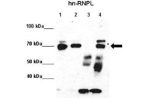 Amount and Sample Type :  Lane 1: 5% InputLane 2: 5% SupLane 3: Normal IgGLane 4: hn-RNPL ppt.